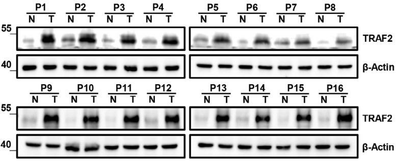 Western Blot analysis of TRAF2.jpg